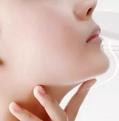 丰下巴可以改善下巴后缩么,丰下巴手术前后对比照片