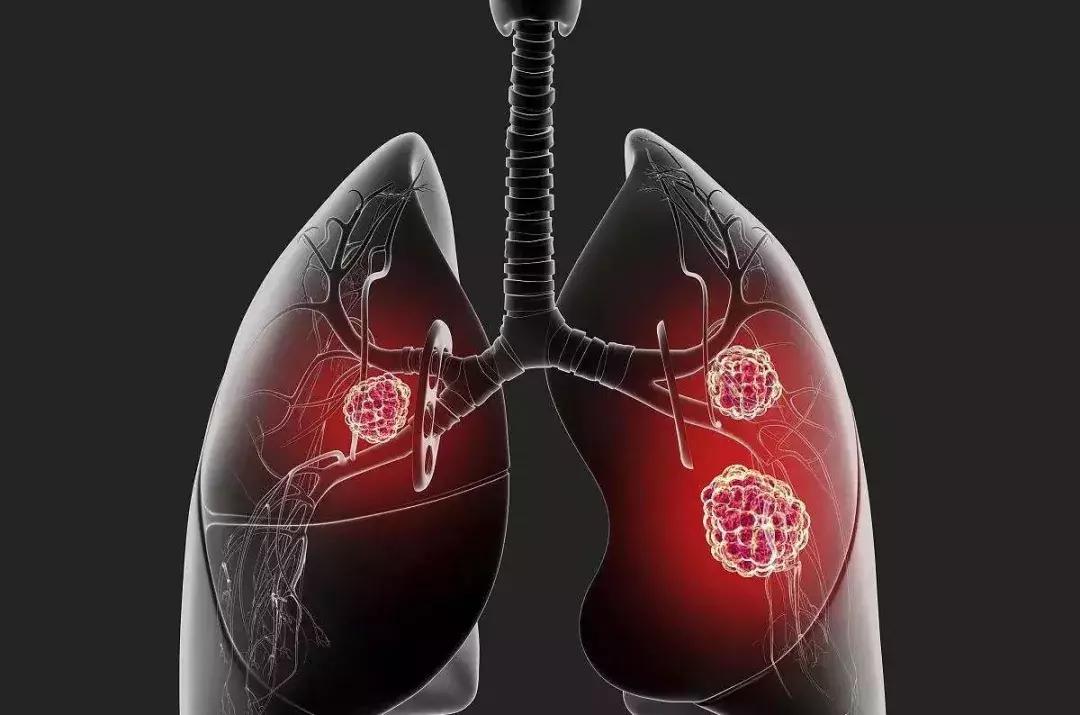 脸颊反反复复长痘就是有炎症,脸上像打了腮红一样是什么原因