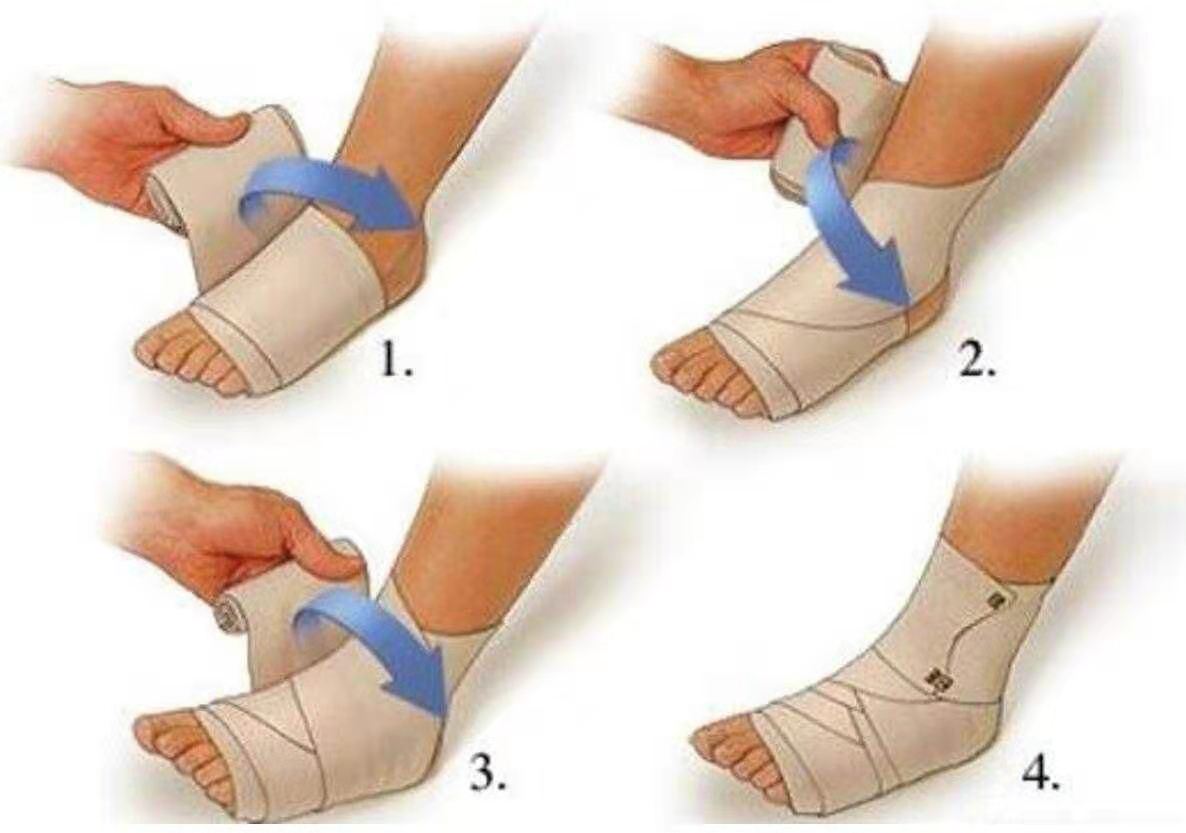 踝关节扭伤陈年旧伤如何康复,踝关节扭伤后下楼梯怎么康复