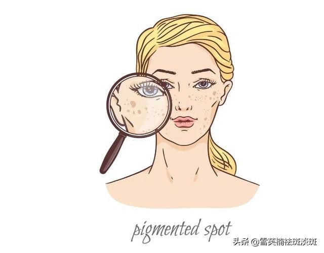 脸上怎么祛斑可靠,吃祛斑药物真能快速祛斑吗