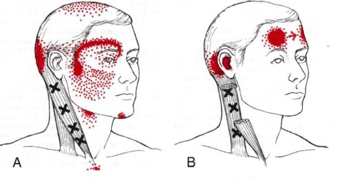 从小就弯腰驼背颈椎病怎么办,16岁颈椎病