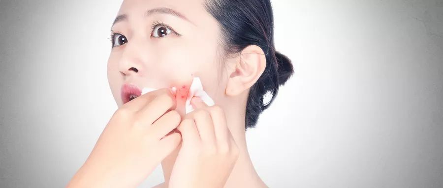 痘痘怎么治最快最有效的方法,痘痘怎么治疗最快有效