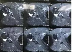 中超运动员受伤,足球黄嘉俊