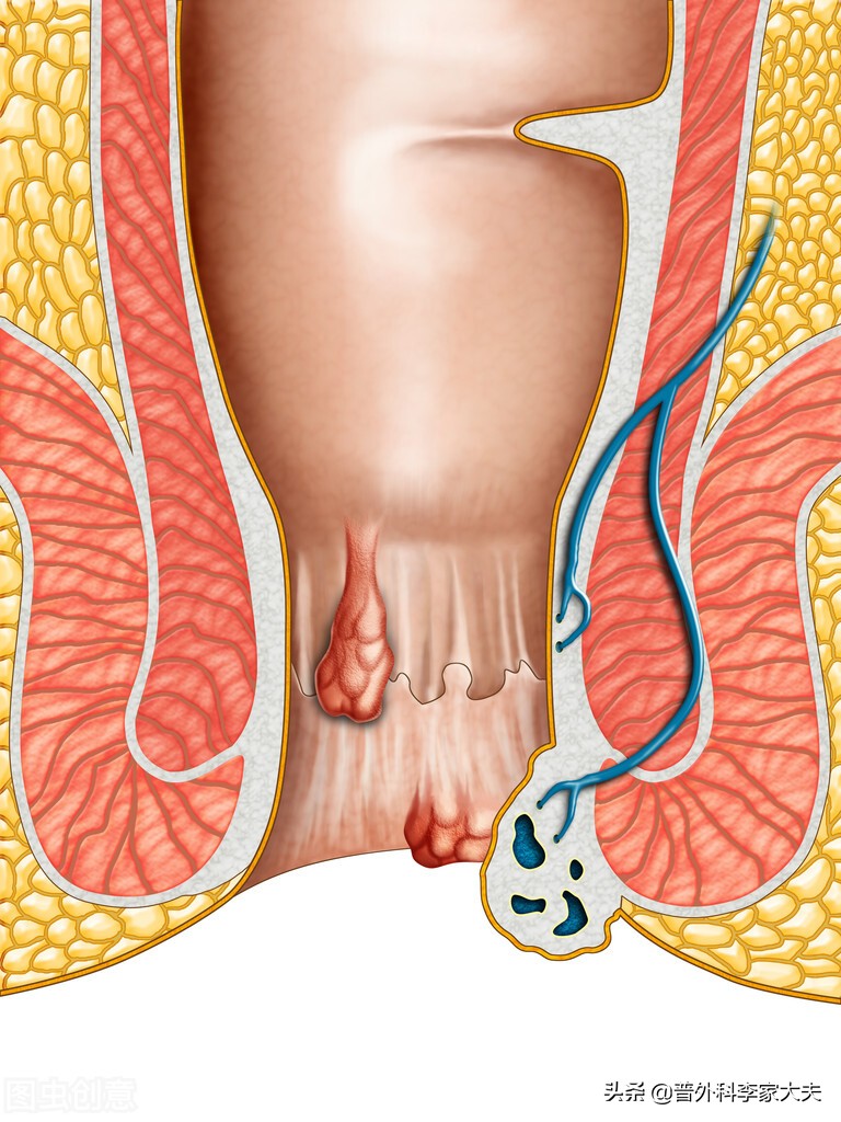 肛门和直肠疼痛是什么症状,肛门直肠痛的症状有哪些
