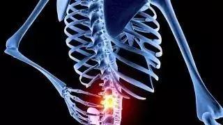 腰椎间盘突出各种治疗方法,最有效的腰椎间盘突出治疗方法