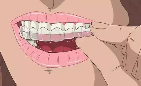 找了3个大学妹子聊聊：为什么在最美好的年纪戴牙套