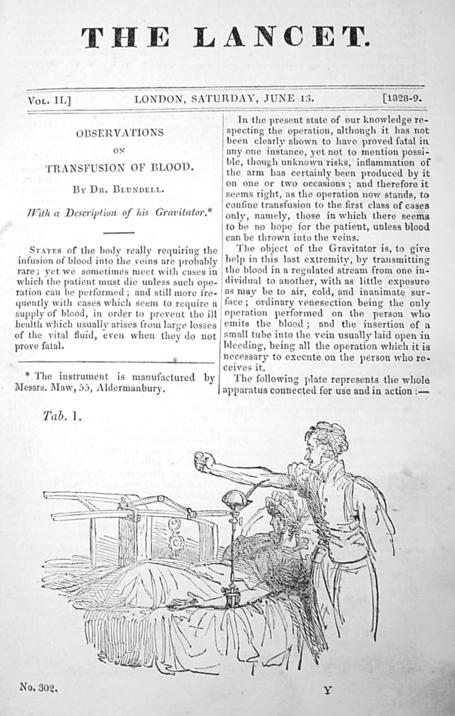 输血的基本原理是什么,输血的科学常识