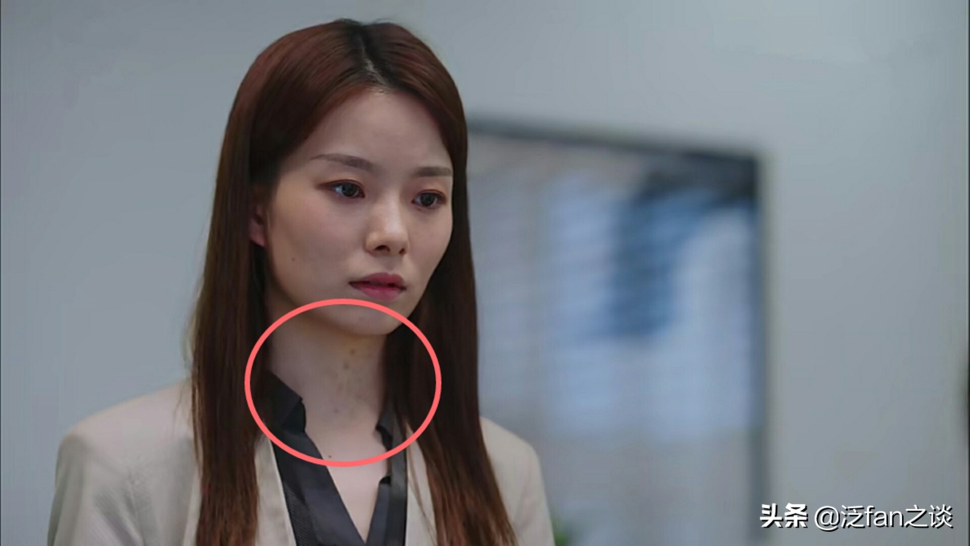 陈卓璇脖子的胎记用什么遮住了,陈卓璇谈胎记