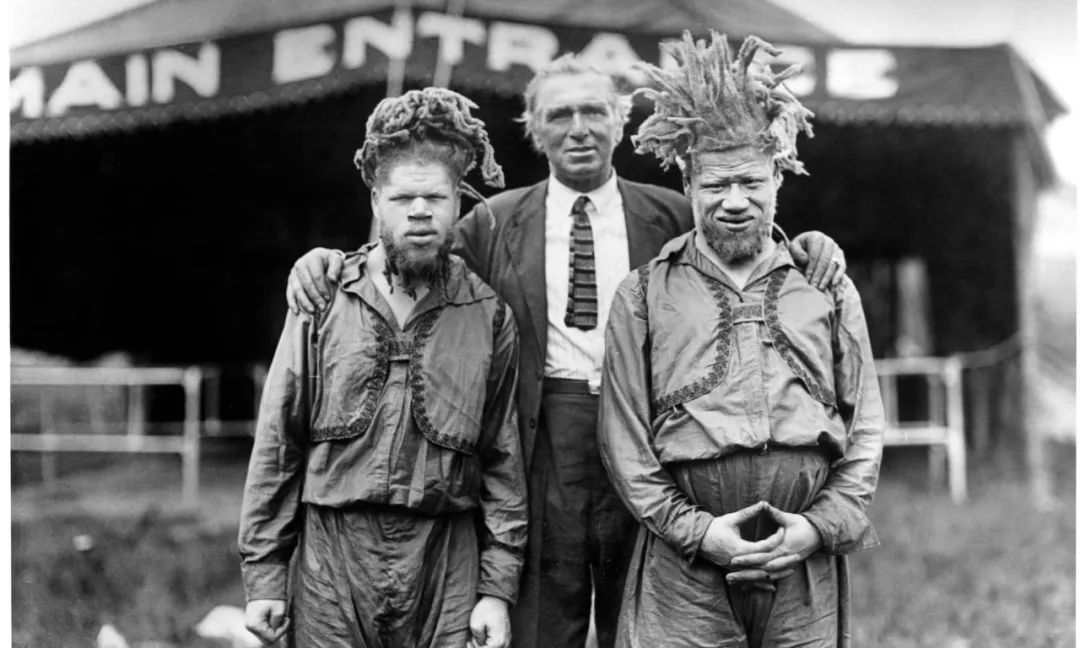 得了白化病的黑人，在百年前的美国，被迫出演畸形秀、被残忍猎杀