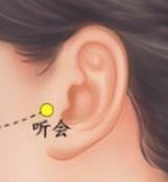 耳鸣一般不需治疗自己会消失,出现耳鸣要立即去医院吗