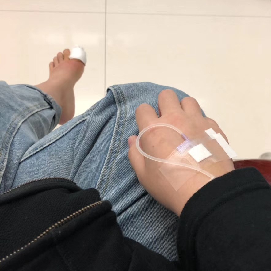 拔一根脚毛脚肿了,拔了脚趾甲后整个脚肿了怎么回事