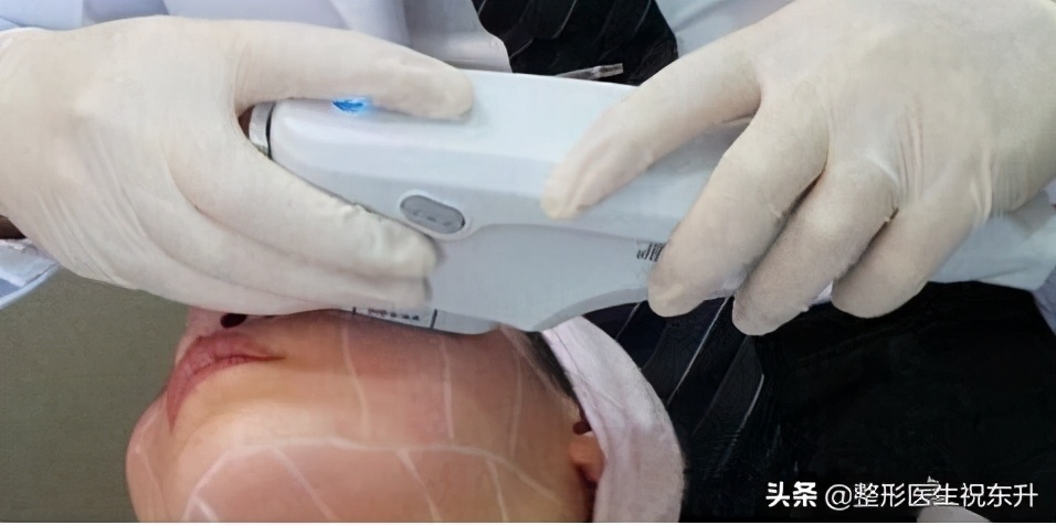 去除法令纹的最有效的方法是什么,去除法令纹最有效的方法是什么