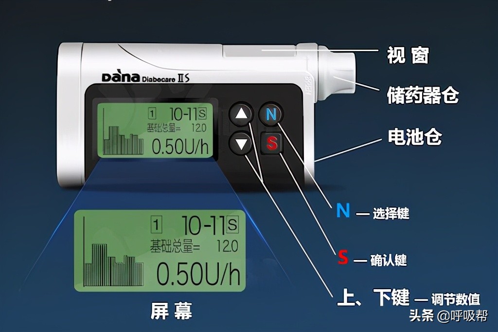 优泵和丹纳泵的比较,优泵胰岛素泵家庭版和专业版区别