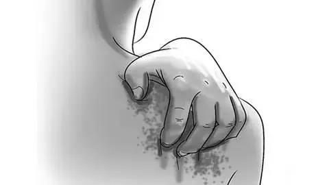 糖尿病会引起皮肤瘙痒有红块图片,糖尿病人皮肤瘙痒用什么药来止痒