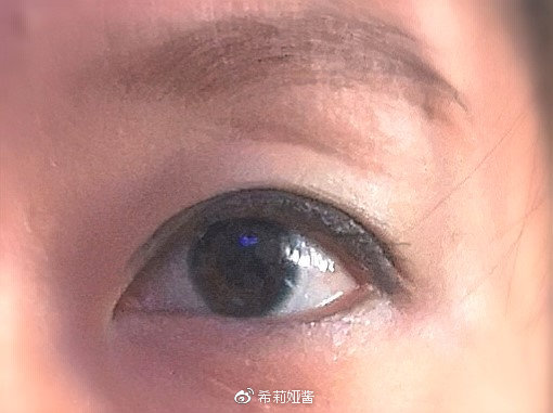 隐形眼镜需要高一点吗,隐形眼镜要硬的好还是软的好