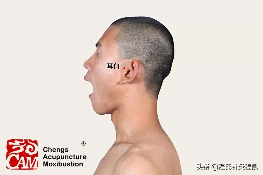 颈椎病引起的耳鸣按摩什么穴位,右耳耳鸣按摩什么穴位视频