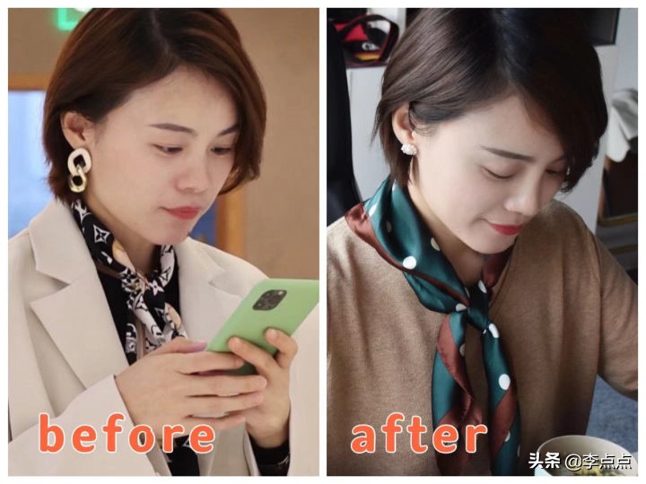 熬夜写完了医美后续，美真的是要付出代价的