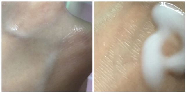 到底是油皮好还是干皮好,不管干皮还是油皮都要补水吗