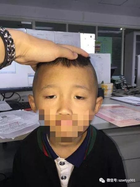 4-6岁儿童自测视力结果,6岁小孩测视力1.0需要看清几个