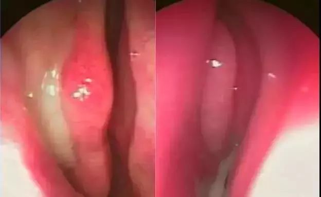 儿童鼻痒鼻塞鼻炎用什么喷剂,鼻腔缓解喷雾