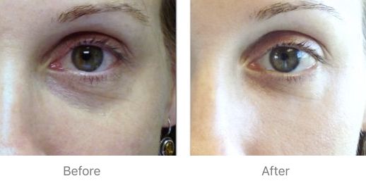 又是激凸又是露底，“蜜桃肌”的盛世美颜也有翻车时