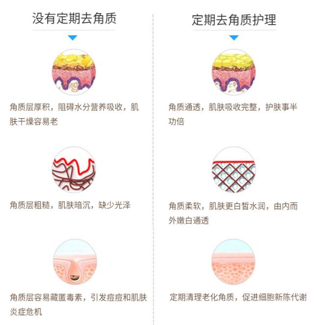 教你搞定肤色暗沉问题,肤色暗沉无光泽怎么改善