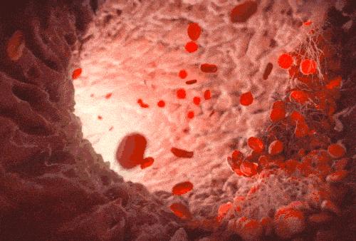 缺钙抽筋的原因及解决方法,缺钙引起的健康问题