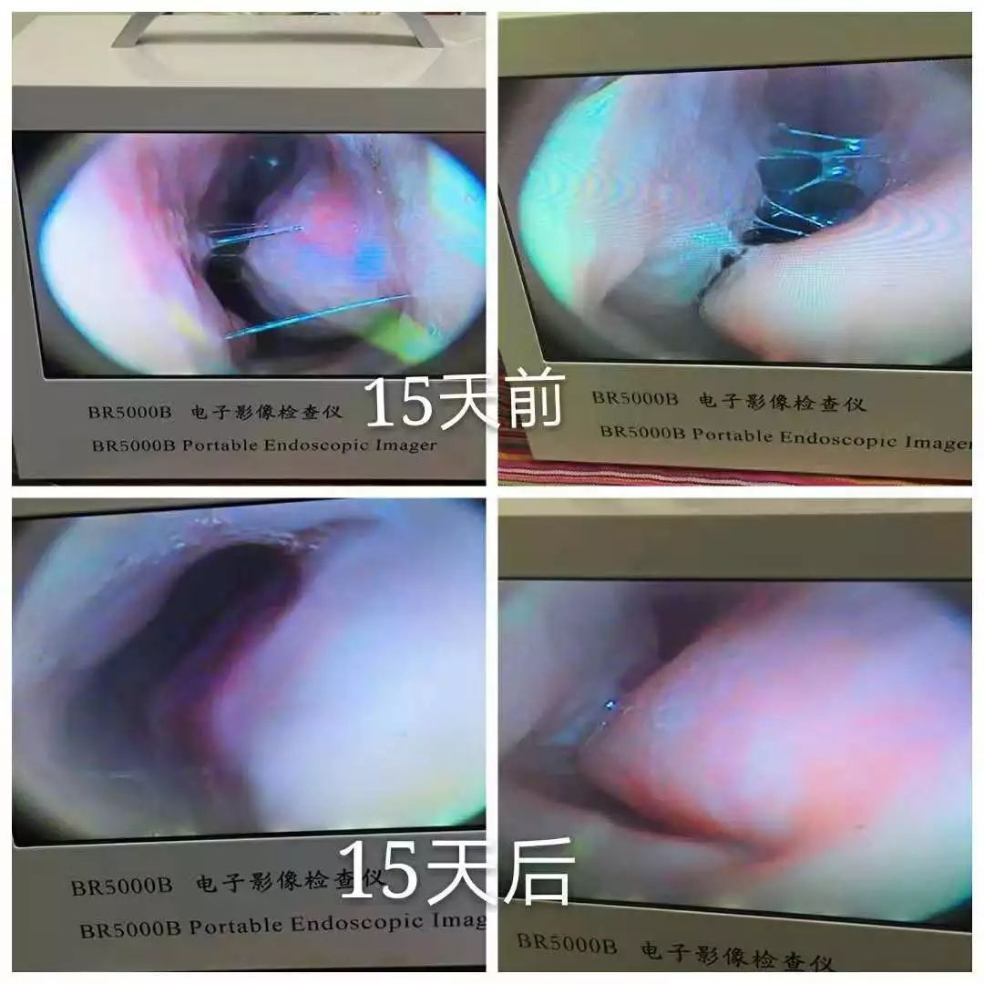 四退原则出炉：“无论什么原因，鼻炎治不好就退款！”常州这家诊所打了谁的脸？