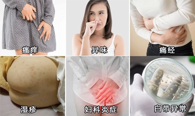 瘙痒难忍、有异味、反复发作，是你这里出了问题！