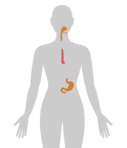 18张癌症人体地图，揭秘致癌真相！