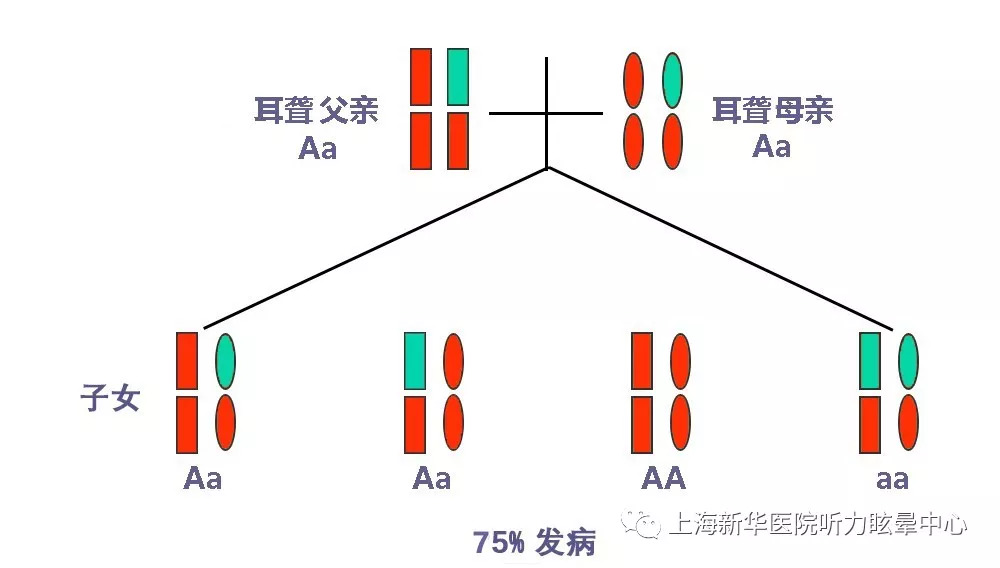 遗传性耳聋怎样可以不遗传下一代,遗传性的耳聋是怎么引起的