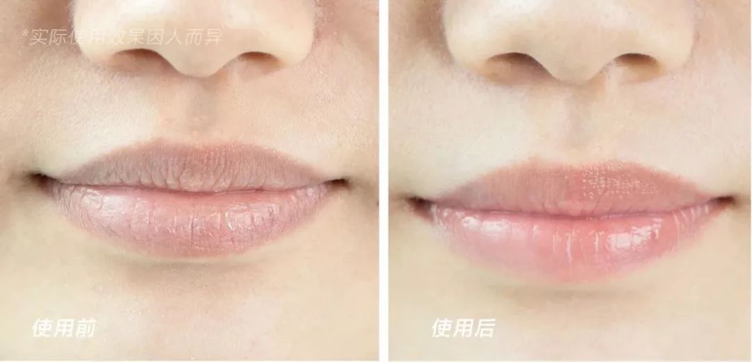 唇炎适合涂的唇膏推荐,四季唇干起皮用什么唇膏最好