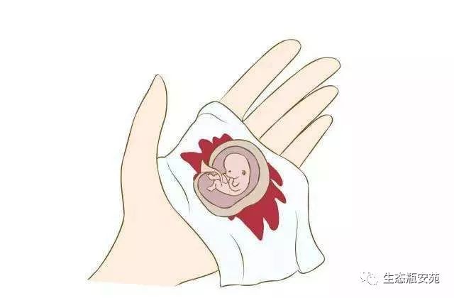 不同人群避孕措施,人工流产后几个月避孕