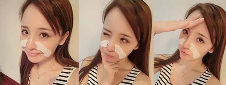 微晶法令纹贴抗皱纹提拉紧致面膜,淡纹抗皱法令纹面膜推荐