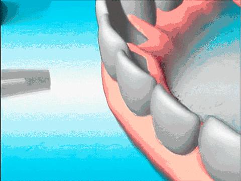 男子梅毒的10个征兆,患了梅毒是不是一定要彻底治愈