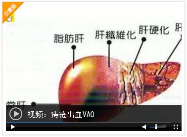 25岁女孩突然痔疮大出血,女子车祸脑出血医生紧急抢救后续