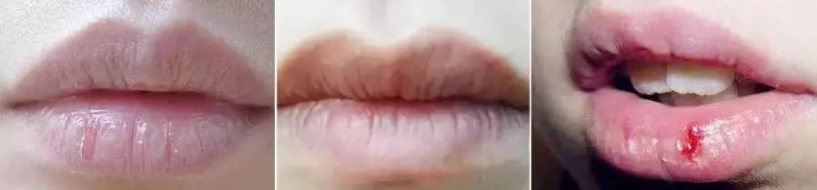 风靡泰国，男女必备的打啵神器，这支润唇膏涂一次等于敷10次唇膜