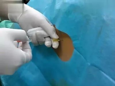 石家庄生三胎政策最新,石家庄生二胎最新政策