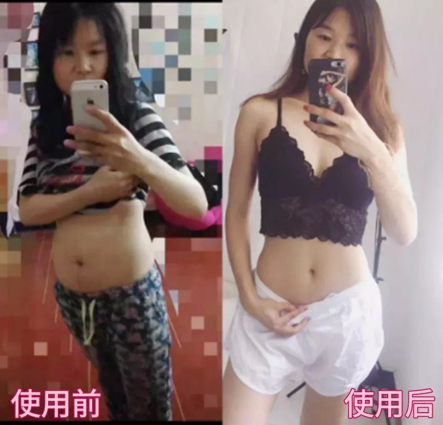 躺着减肥瘦肚子神器,能瘦肚子的瘦身贴