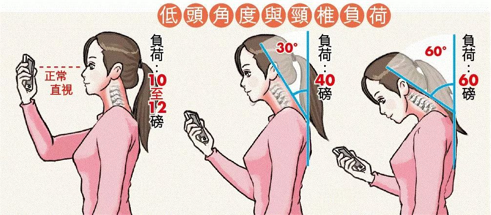 颈椎僵硬劳累,颈椎僵硬肩部酸痛的有效缓解方法