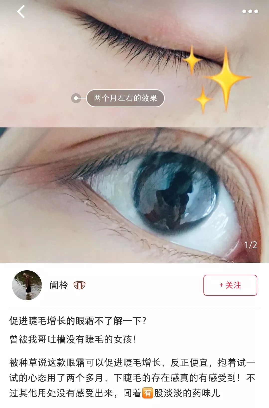 马应龙祛黑眼圈神器,国外马应龙痔疮膏去黑眼圈