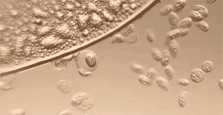 洗衣机里加上它陈年污垢全出来了,洗衣机污垢和霉菌危害