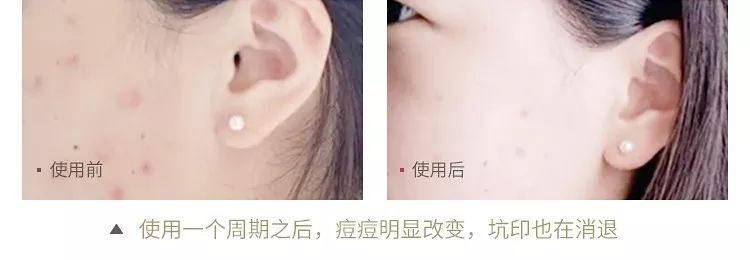 把洗衣机的残渣污垢排出来,洗衣机的洗涤盒的水垢