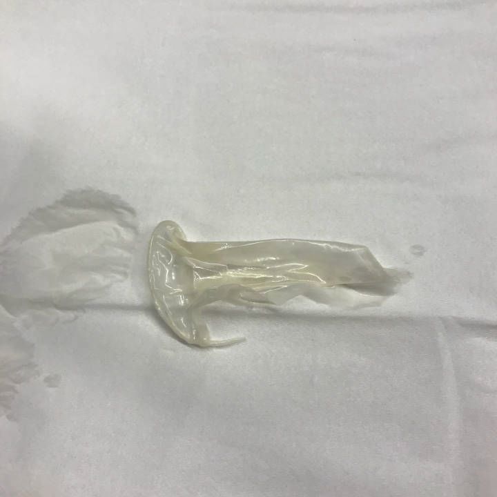 喜茶喝出石头,喜茶喝出玻璃碎原因