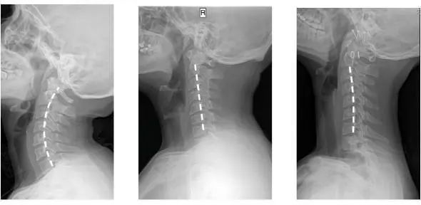 拯救你的颈椎！这款德国变态”护颈”神器，让你坐着比躺着还舒服，连失眠也能救一下