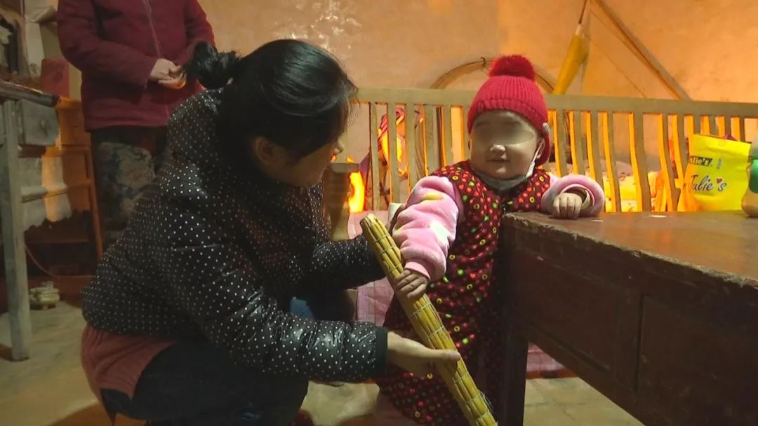 一岁女孩患18种罕见病,女童身患多种罕见病医生不敢治