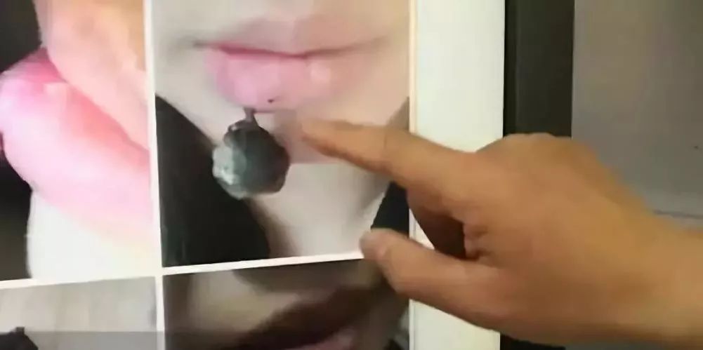 嘴唇干了起皮了可以咬掉吗,嘴唇干起皮咬掉以后会留疤吗