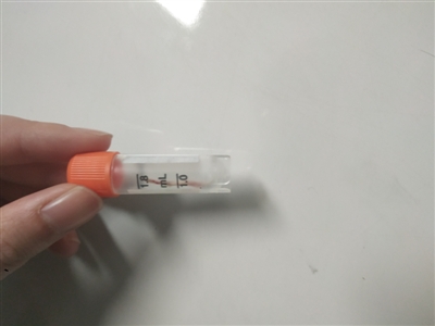 喝鱼汤卡住喉咙死亡,鱼刺扎破食道开胸手术