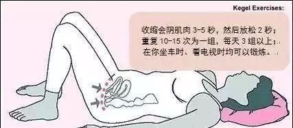 月子期间要做盆底肌修复吗,月子里可以用盆底肌修复吗