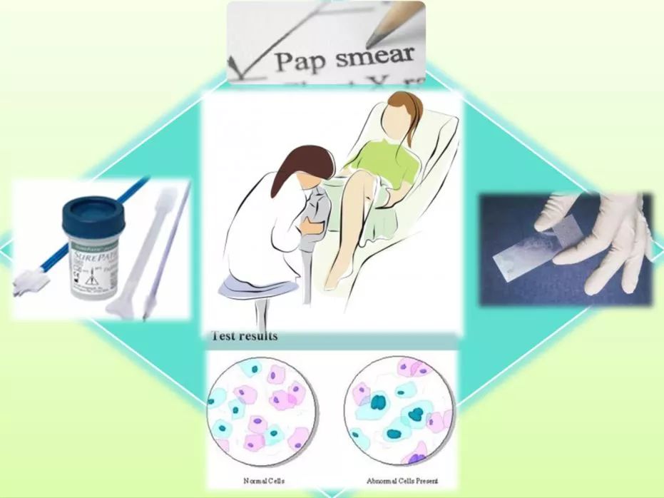 为何hpv疫苗预约都没号,hpv疫苗一年预约超过两次该怎么办